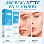 Charger l'image dans la galerie, Gel Anti-Acné MOOYAM-Élimine les Impuretés Réduction Visible des Boutons - Lunarexe ®
